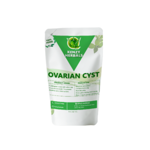 ovarian-cyst